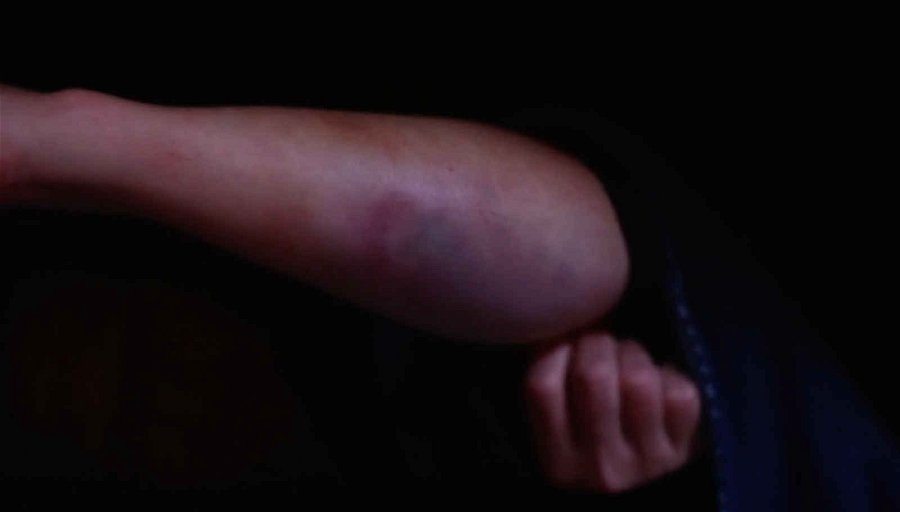 Otäcka halkolyckan i Över Atlanten – Maria Montazami får inre blödning